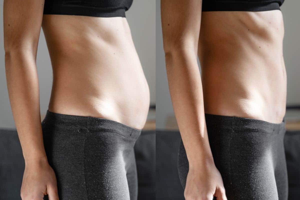 Post-Pregnancy: What Happens to Your Abdominal Muscles After Birth Braintree