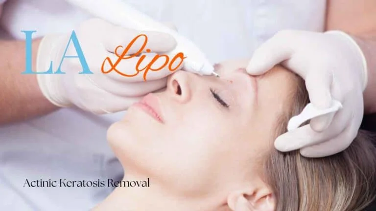 Woman receiving Actinic Keratosis Removal Treatment Braintree