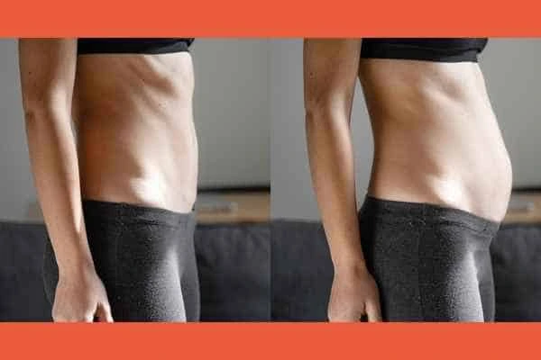 LA-EMS Body Sculpting results Braintree