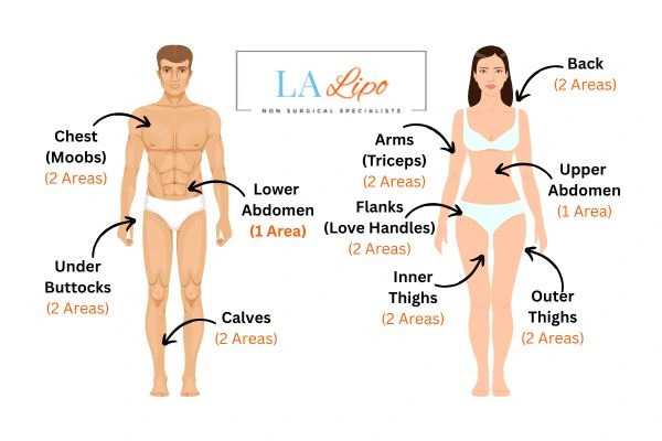 LA LIPO Cryolipolysis Areas Braintree