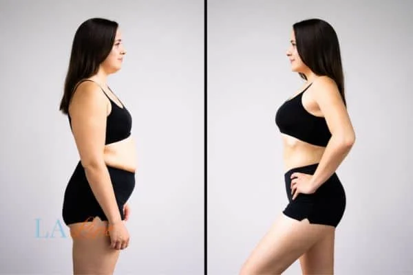 link between body image and mental health Braintree