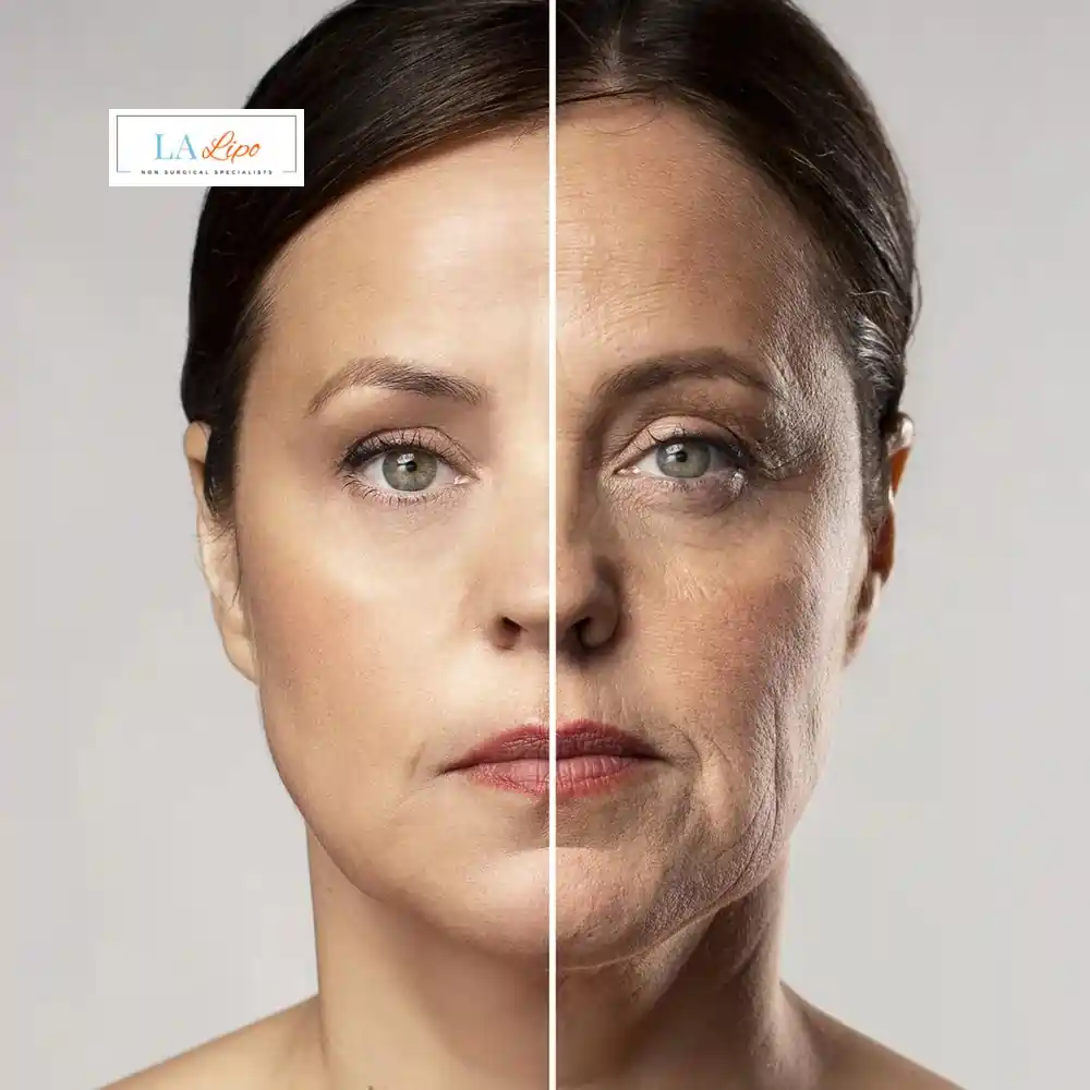 How Can You Tell If Non-Surgical Skin Tightening Is Right for You Braintree?