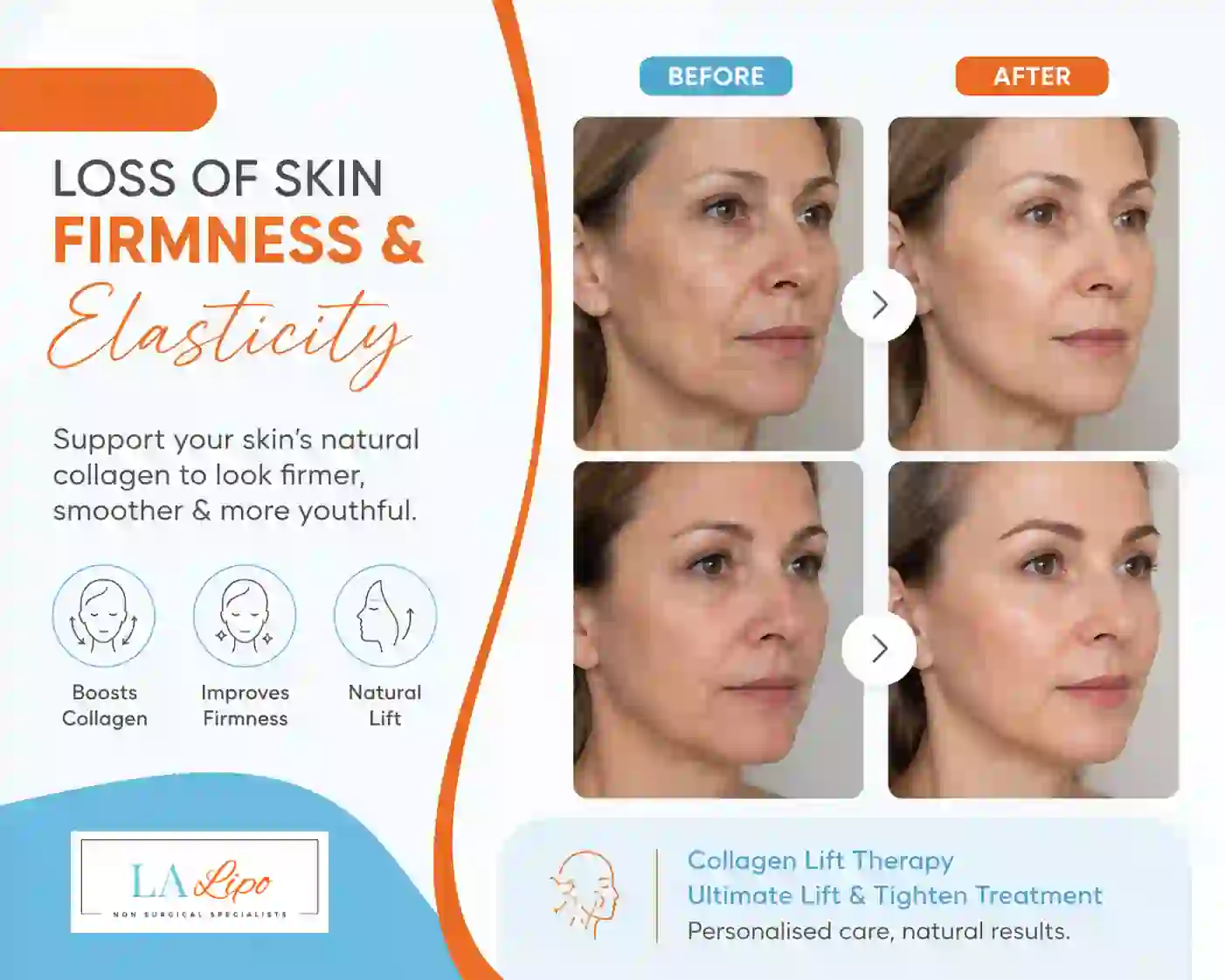 Sign #7: Loss of Skin Firmness and Elasticity Braintree