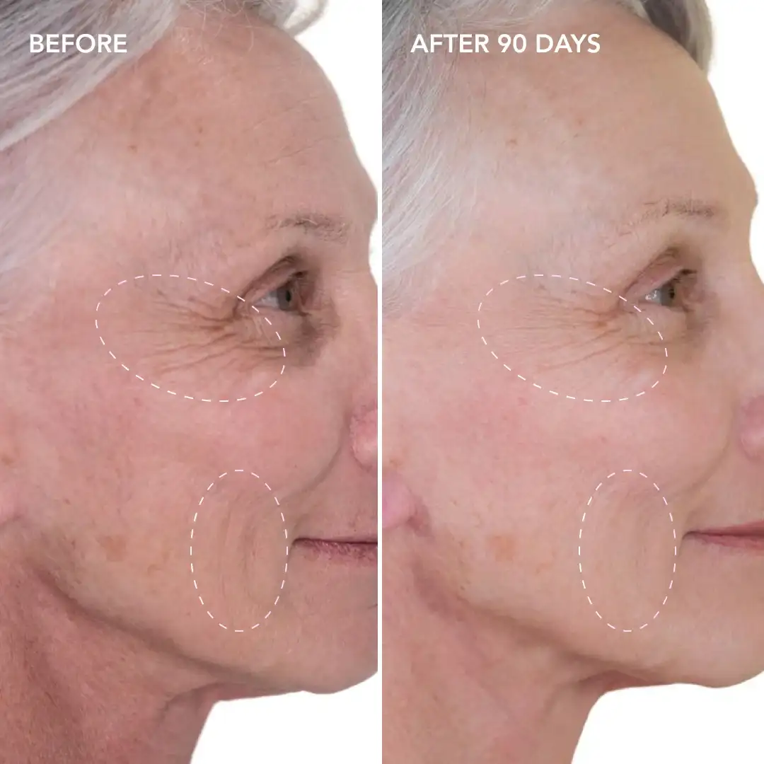When will you see results Braintree